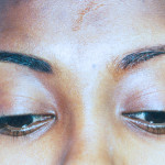 Permanent eyebrows