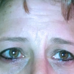 Permanent eyeliner swelling