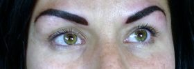 Permanent eyebrows